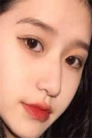 笑得頭掉了，你快幫我安上